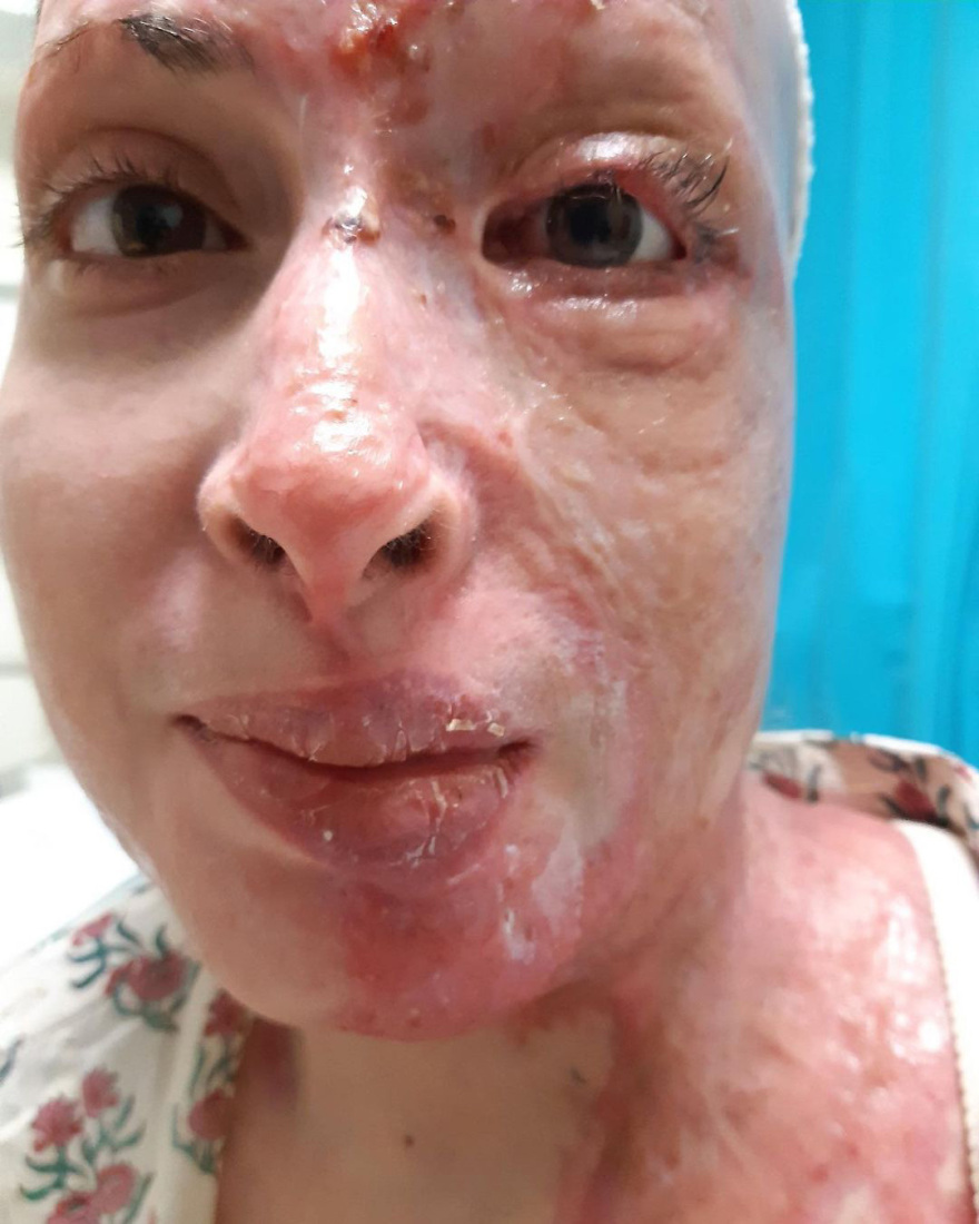 Ιωάννα Παλιοσπύρου: Η συγκλονιστική ανάρτηση με φωτογραφίες από τα χειρουργεία - Προσοχή σκληρές εικόνες