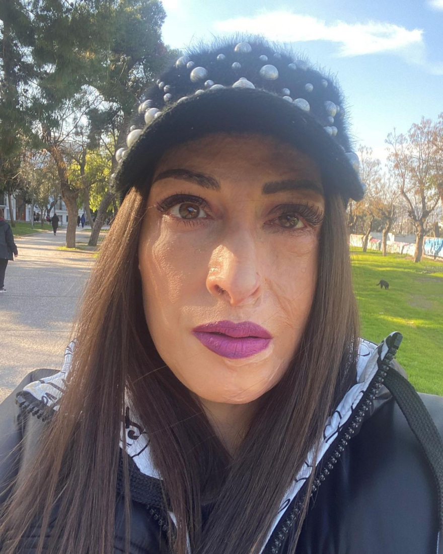 Ιωάννα Παλιοσπύρου: Η συγκλονιστική ανάρτηση με φωτογραφίες από τα χειρουργεία - Προσοχή σκληρές εικόνες