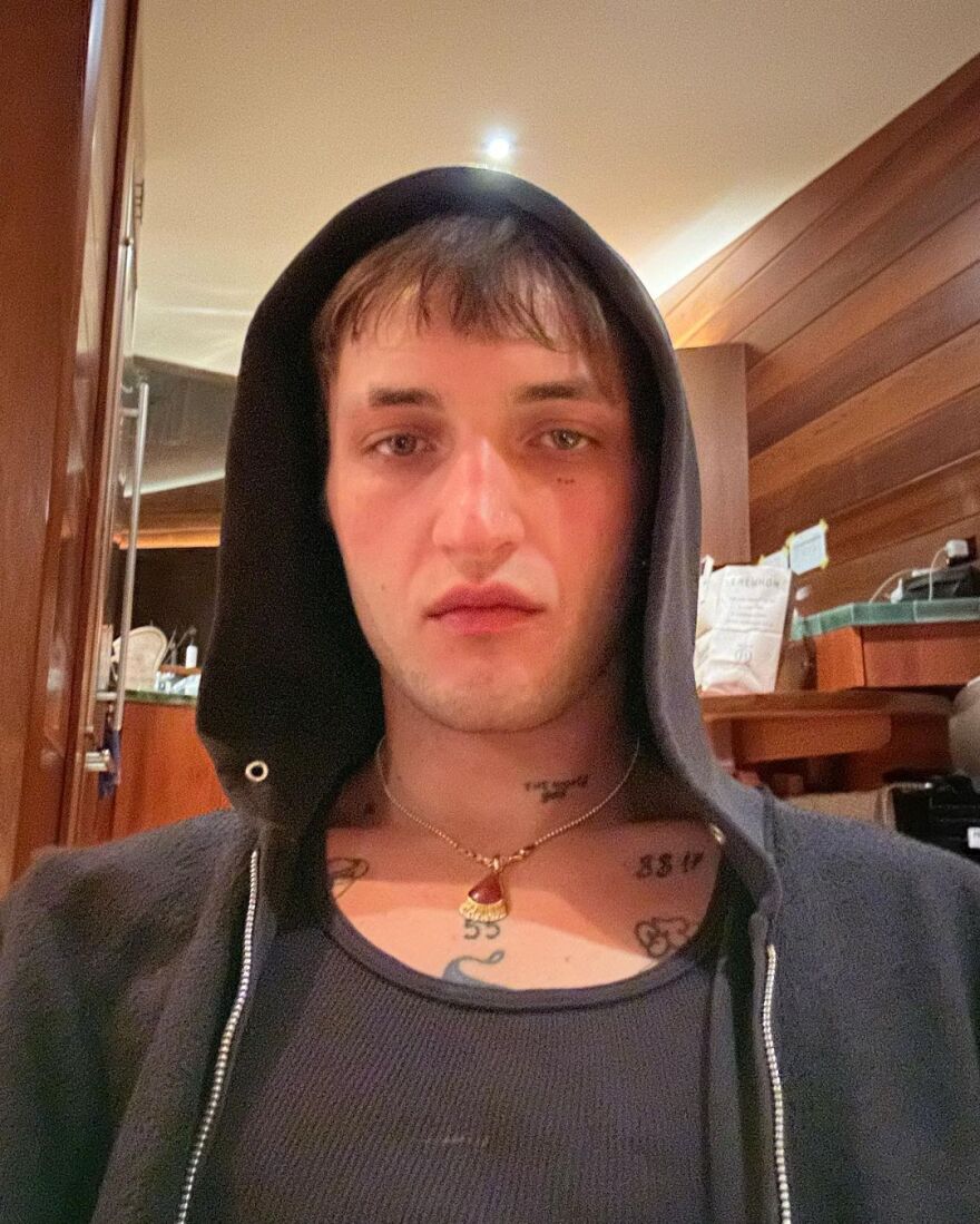 Ανουάρ Χαντίντ: «Προσπαθώ να μην τον βρω και τον σκοτώσω» - Η αινιγματική ανάρτηση του πρώην της Ντούα Λίπα