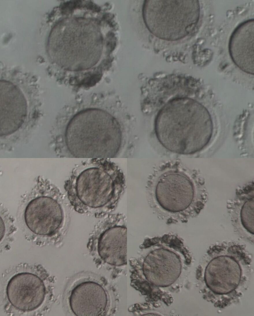 Ελεονώρα Μελέτη για την κρυοσυντήρηση ωαρίων: «Σαν σήμερα το 2017 έκανα ένα από τα πιο σημαντικά πράγματα στη ζωή μου»