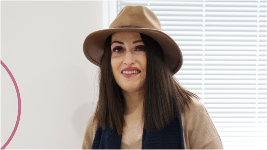 Ιωάννα Παλιοσπύρου: «Έχω κάνει περίπου 20 χειρουργεία και δεν έχω κλάψει ποτέ όταν μπαίνω»