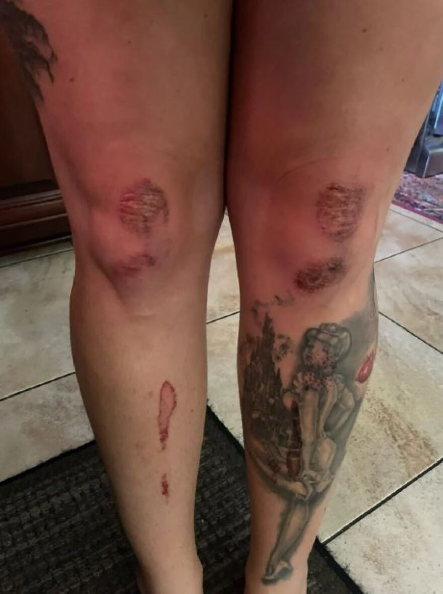 ΗΠΑ: Ντροπιαστικό ατύχημα για 26χρονη - Έκανε διάδρομο στο γυμναστήριο και κατέληξε ημίγυμνη