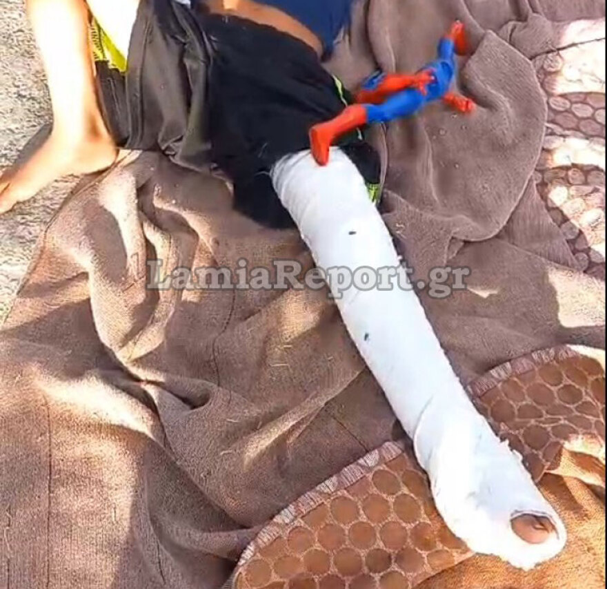 Λαμία: Απίστευτο βίντεο - Χτύπησε με το μηχανάκι 5χρονο, τον κλώτσησε και τον εγκατέλειψε