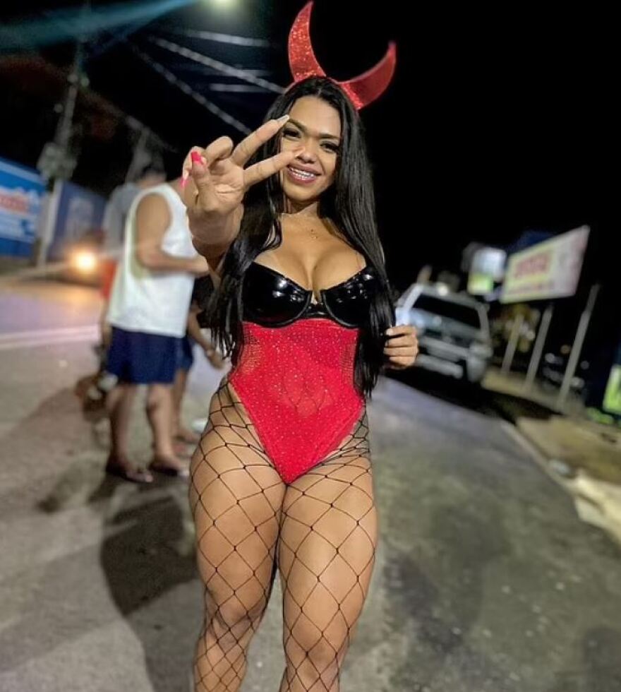 Βραζιλία: Τρομακτικό ατύχημα - Σέξι χορεύτρια τον χτύπησε με τα οπίσθια και εξαρθρώθηκε ο αγκώνας του