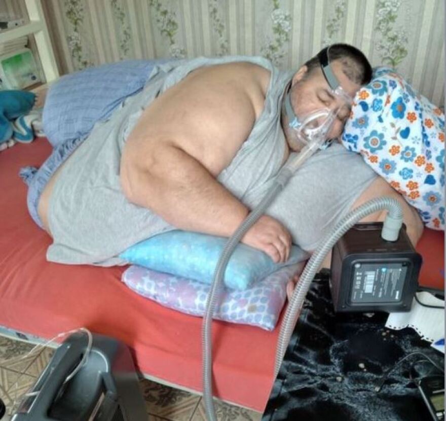 Κομοτηνή: Ασθενής που ζυγίζει... 360 κιλά καταγγέλλει ότι το ΕΚΑΒ αρνείται να τον μεταφέρει στο νοσοκομείο