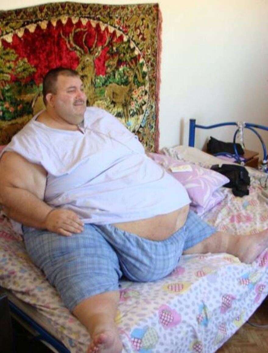 Κομοτηνή: Ασθενής που ζυγίζει... 360 κιλά καταγγέλλει ότι το ΕΚΑΒ αρνείται να τον μεταφέρει στο νοσοκομείο