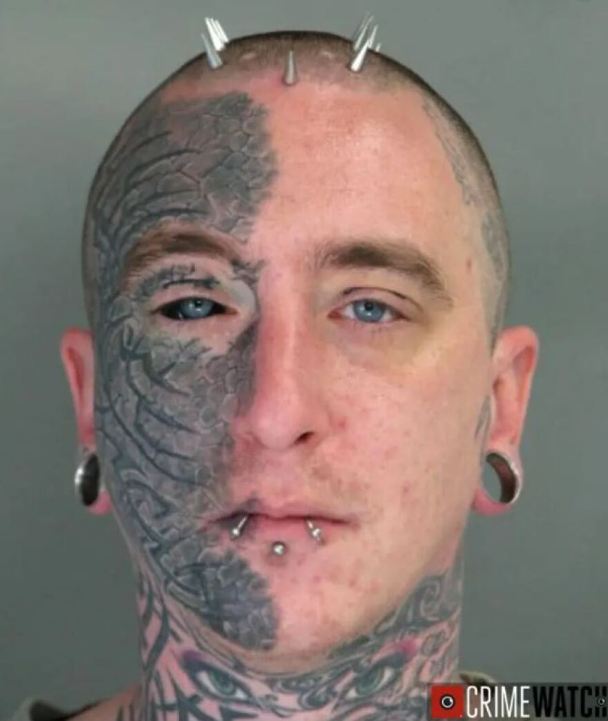 Φρίκη στο Χάρβαρντ: Ποιοι αγόραζαν το δέρμα και τα ανθρώπινα όργανα που πουλούσε ο διευθυντής του νεκροτομείου