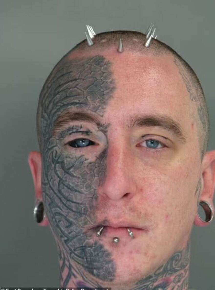 Χάρβαρντ: Ο διευθυντής του νεκροτομείου της σχολής ιατρικής διώκεται για εμπορία οργάνων και λειψάνων