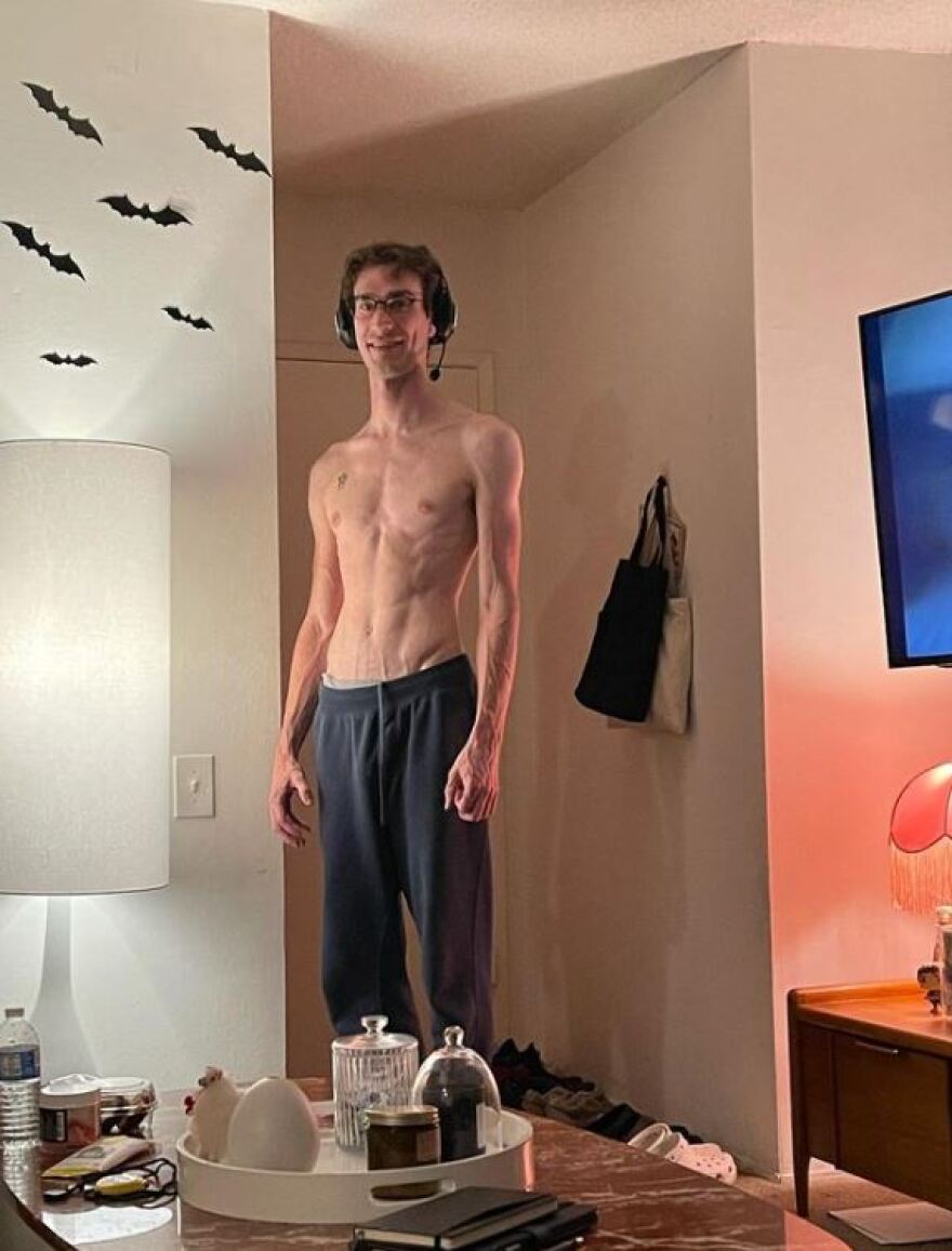 Χιου Χέφνερ: Ο bisexual γιος του κάνει στριπτίζ στο OnlyFans για να αγοράζει... κάρτες Pokemon