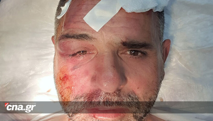 Άγιος Νικόλαος: Πατέρας και γιος έστησαν ενέδρα σε άνδρα και τον ξυλοκόπησαν στη μέση του δρόμου!