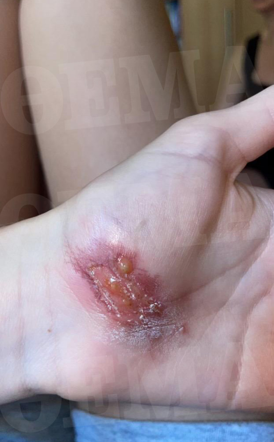 Waterboom Festival: Η στιγμή που σκάει δακρυγόνο μέσα στην αρένα και προκαλεί το απόλυτο χάος