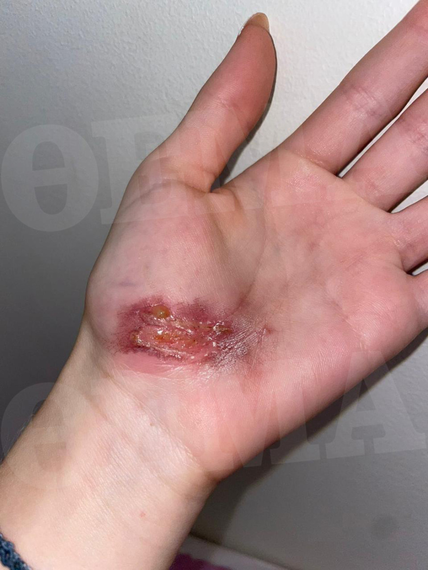 Waterboom Festival: Η στιγμή που σκάει δακρυγόνο μέσα στην αρένα και προκαλεί το απόλυτο χάος