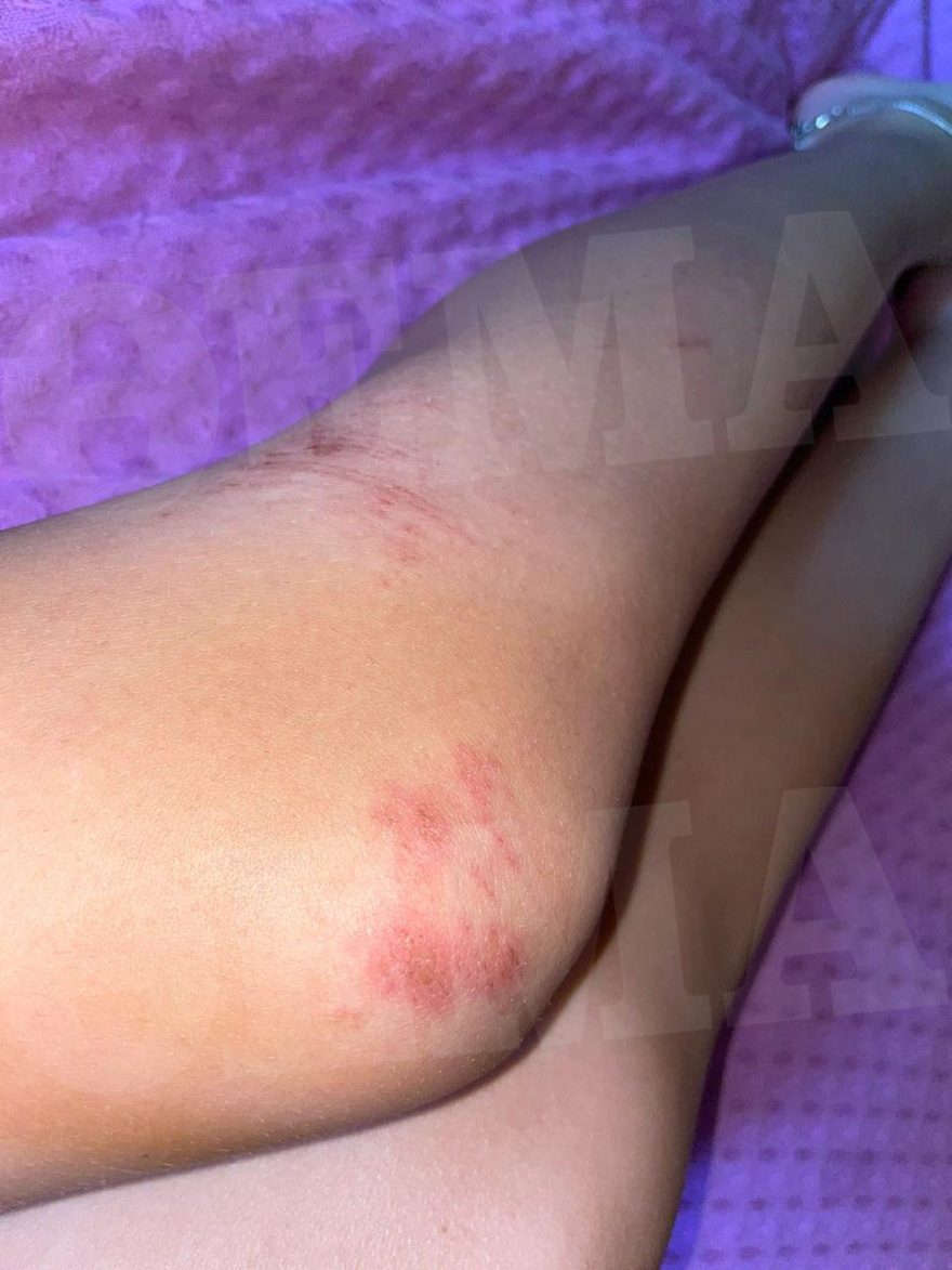 Waterboom Festival: Η στιγμή που σκάει δακρυγόνο μέσα στην αρένα και προκαλεί το απόλυτο χάος