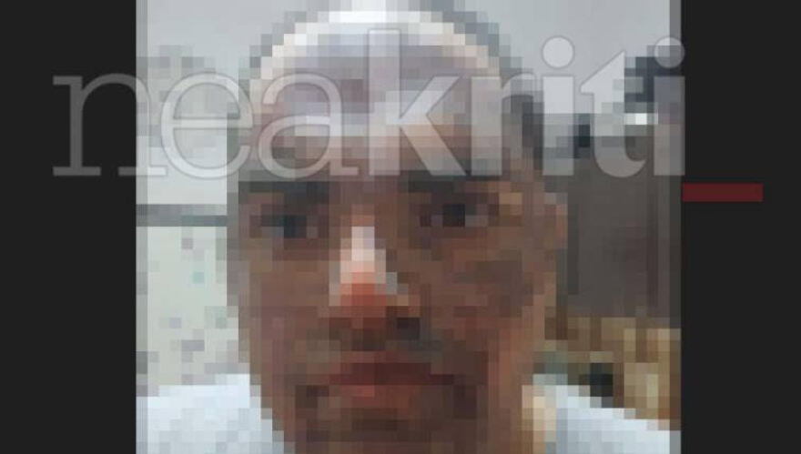 Κρήτη: Εγκαύματα β' βαθμού υπέστη 22χρονος που δούλευε ανασφάλιστος σε εστιατόριο ξενοδοχείο - Έπεσε πάνω του καυτό λάδι