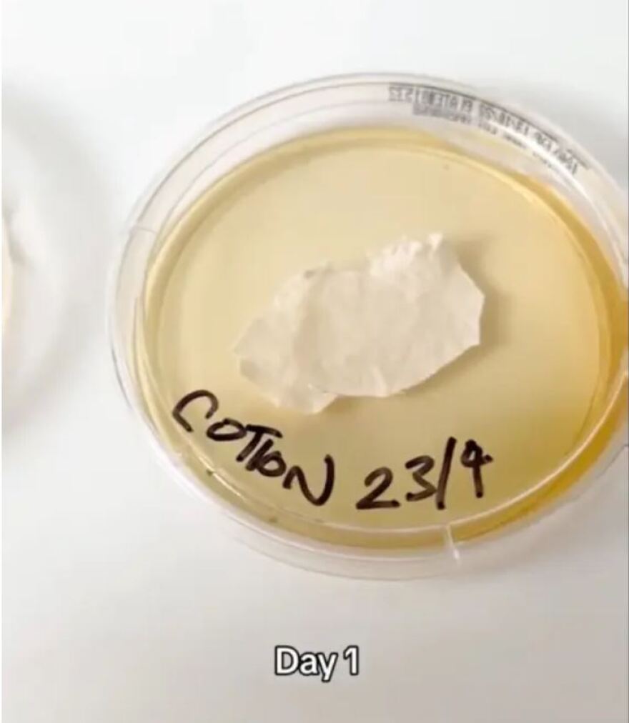 Έρευνα: Οι άπλυτες μαξιλαροθήκες έχουν περισσότερα βακτήρια από το κάθισμα μιας τουαλέτας