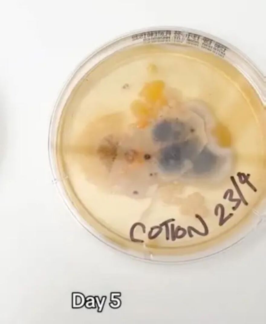 Έρευνα: Οι άπλυτες μαξιλαροθήκες έχουν περισσότερα βακτήρια από το κάθισμα μιας τουαλέτας