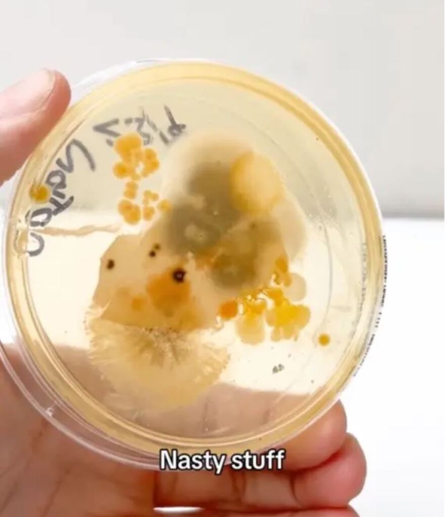 Έρευνα: Οι άπλυτες μαξιλαροθήκες έχουν περισσότερα βακτήρια από το κάθισμα μιας τουαλέτας