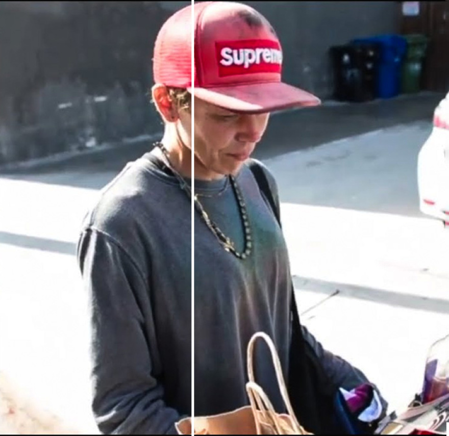 Λόνι Γουίλισον: Νέες φωτογραφίες από το πρώην μοντέλο να ψάχνει φαγητό σε κάδους απορριμμάτων