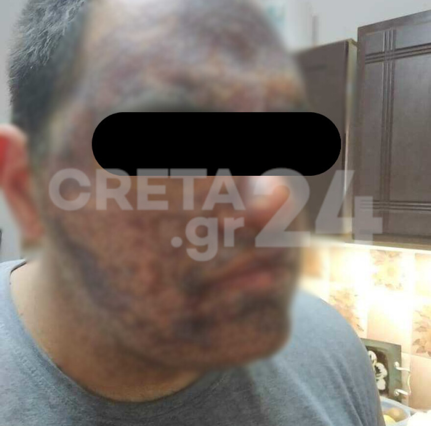 Κρήτη: «Του είπαν ''τελείωνε γιατί βιαζόμαστε'' και χύθηκε το λάδι» - Η οργή της μητέρας του 22χρονου μάγειρα 