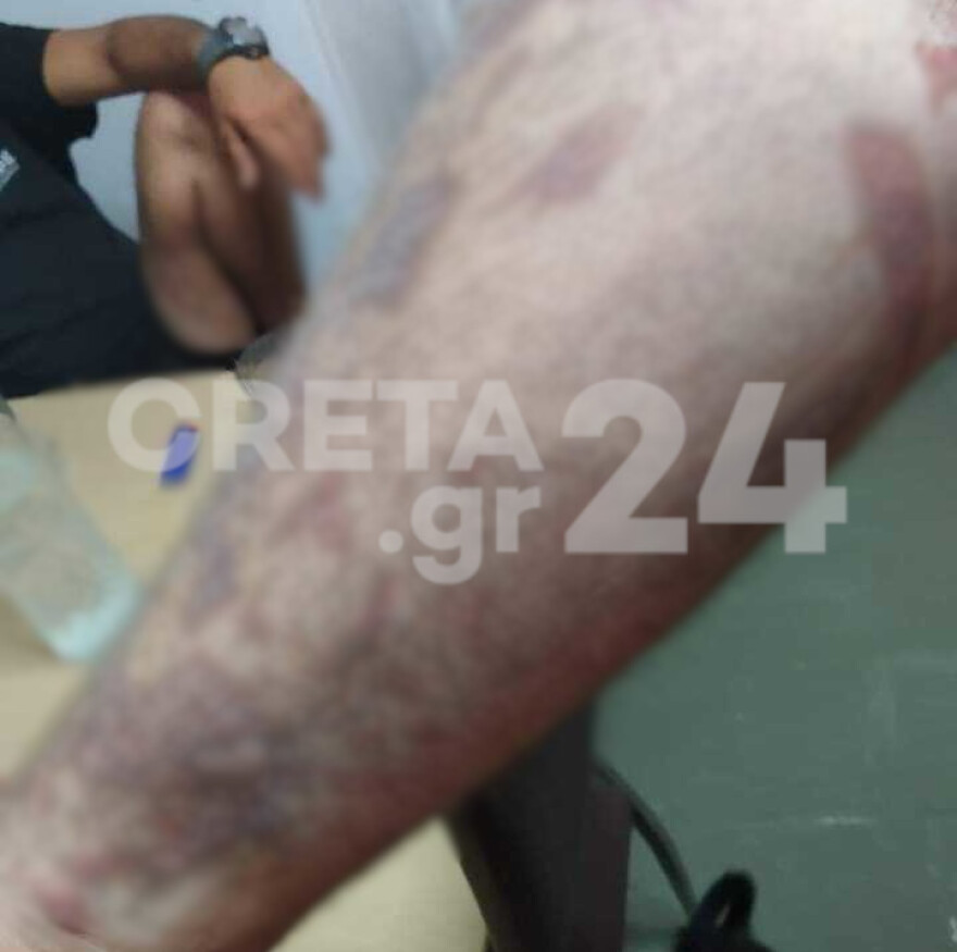 Κρήτη: «Του είπαν ''τελείωνε γιατί βιαζόμαστε'' και χύθηκε το λάδι» - Η οργή της μητέρας του 22χρονου μάγειρα 