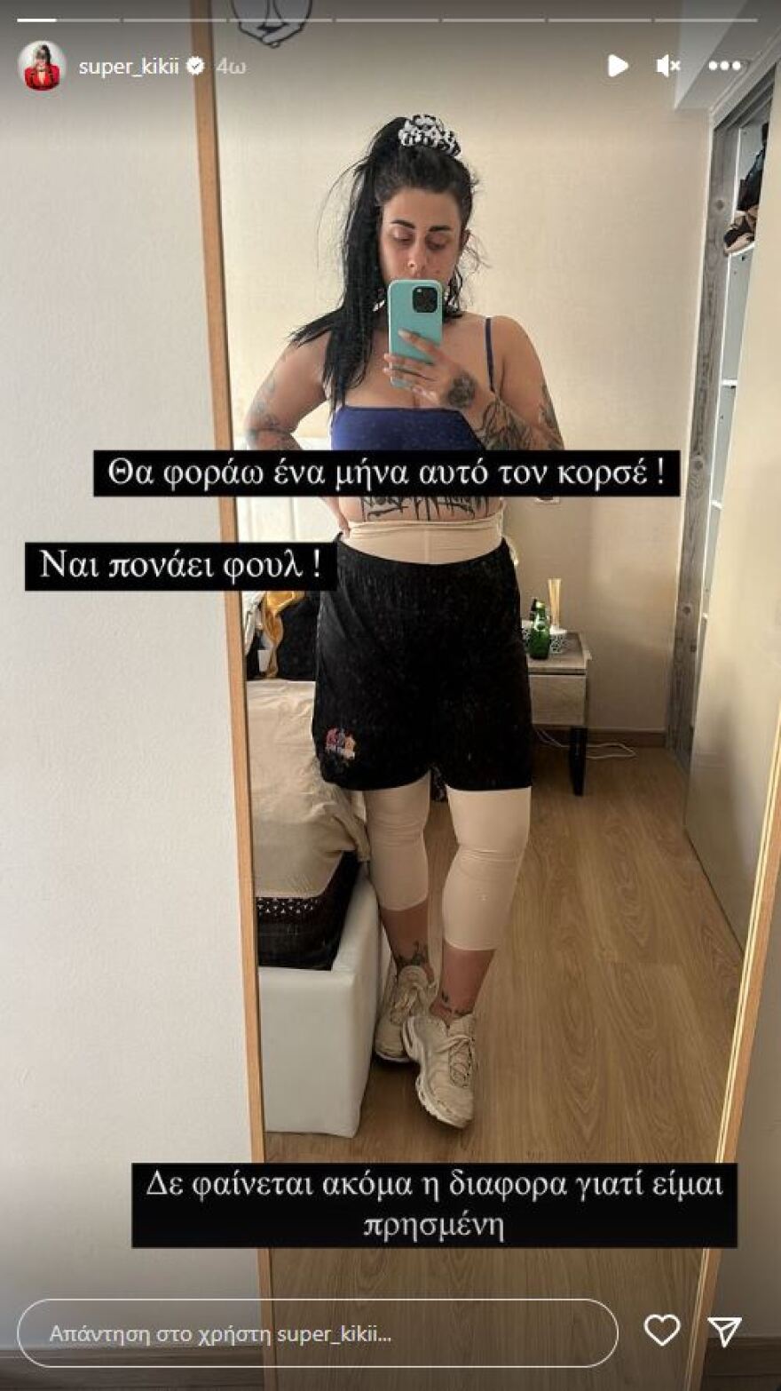 Super Κική: Η πρώτη φωτογραφία μετά την επέμβαση αφαίρεσης λίπους 