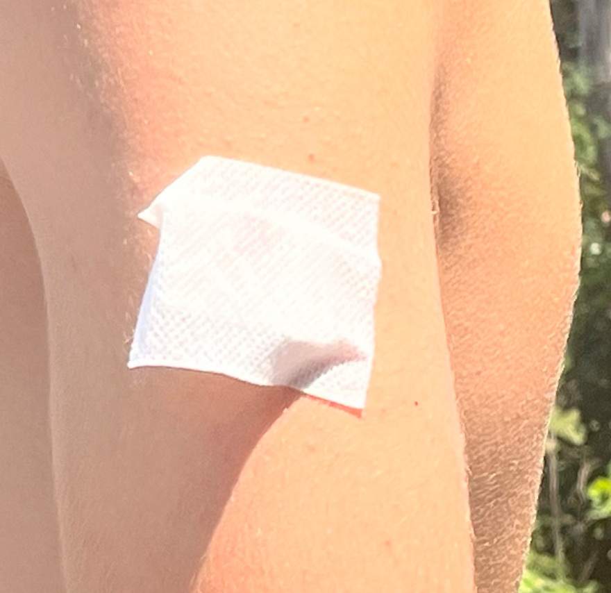 Χαλκιδική: «Νιώσαμε τα σκάγια και γεμίσαμε αίματα» λέει ένας από τους ανήλικους που πυροβόλησε ο 70χρονος