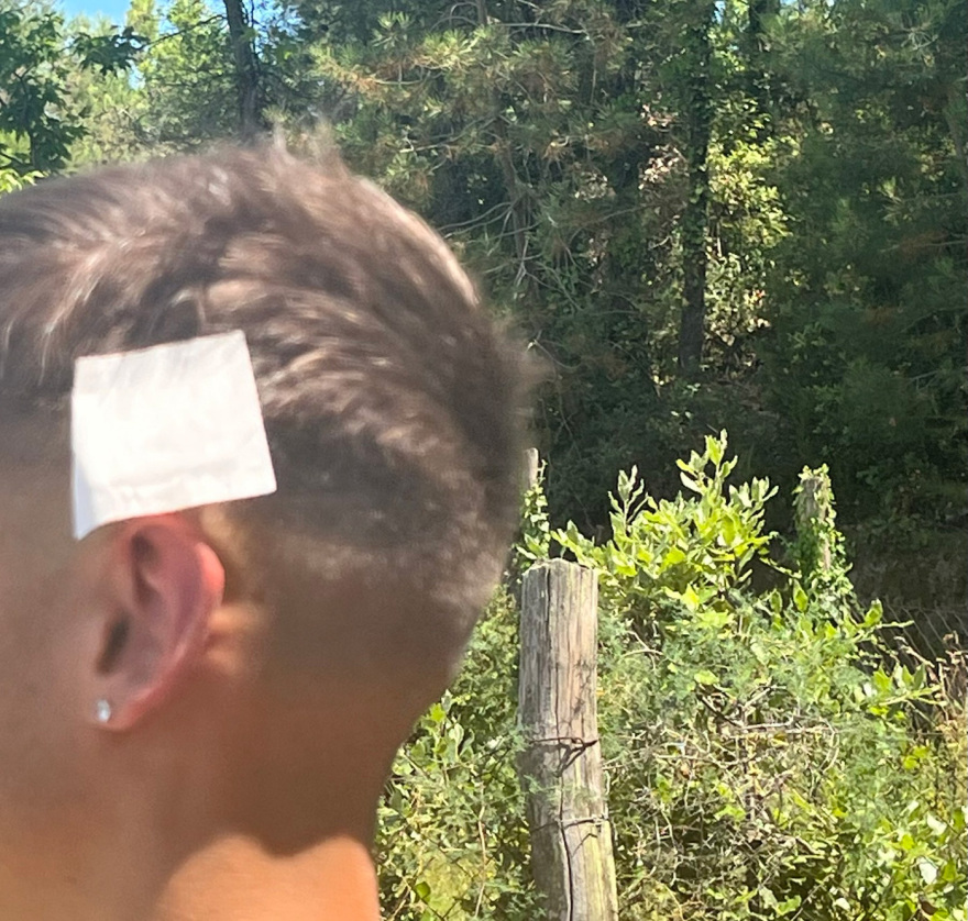 Χαλκιδική: «Νιώσαμε τα σκάγια και γεμίσαμε αίματα» λέει ένας από τους ανήλικους που πυροβόλησε ο 70χρονος