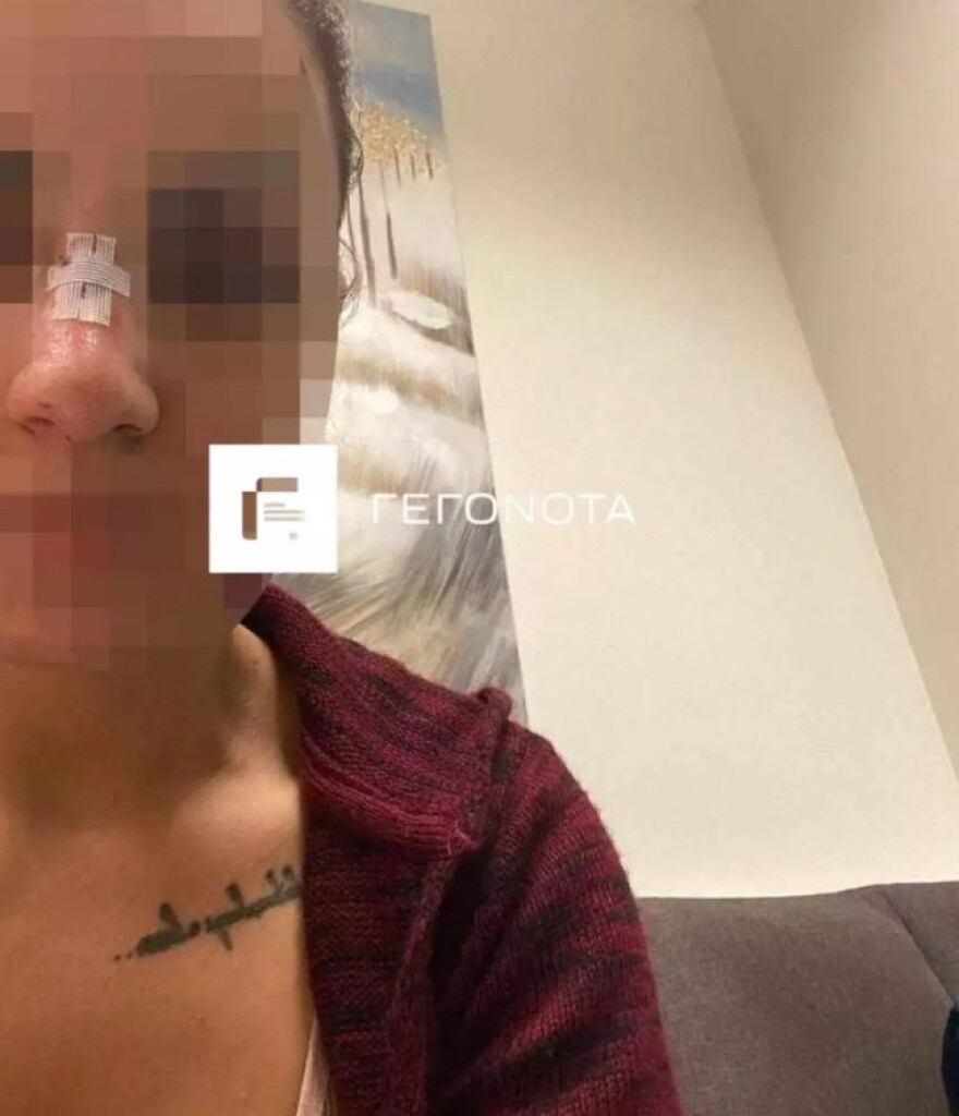 Βόλος: Διεθνής αθλητής κατηγορείται για τον ξυλοδαρμό της πρώην συζύγου του - Δείτε φωτογραφίες