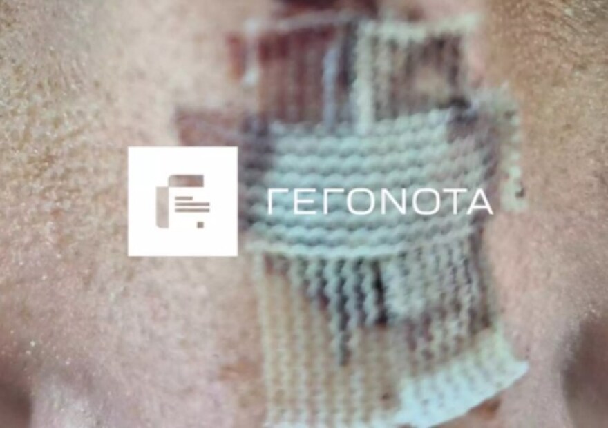 Βόλος: Διεθνής αθλητής κατηγορείται για τον ξυλοδαρμό της πρώην συζύγου του - Δείτε φωτογραφίες