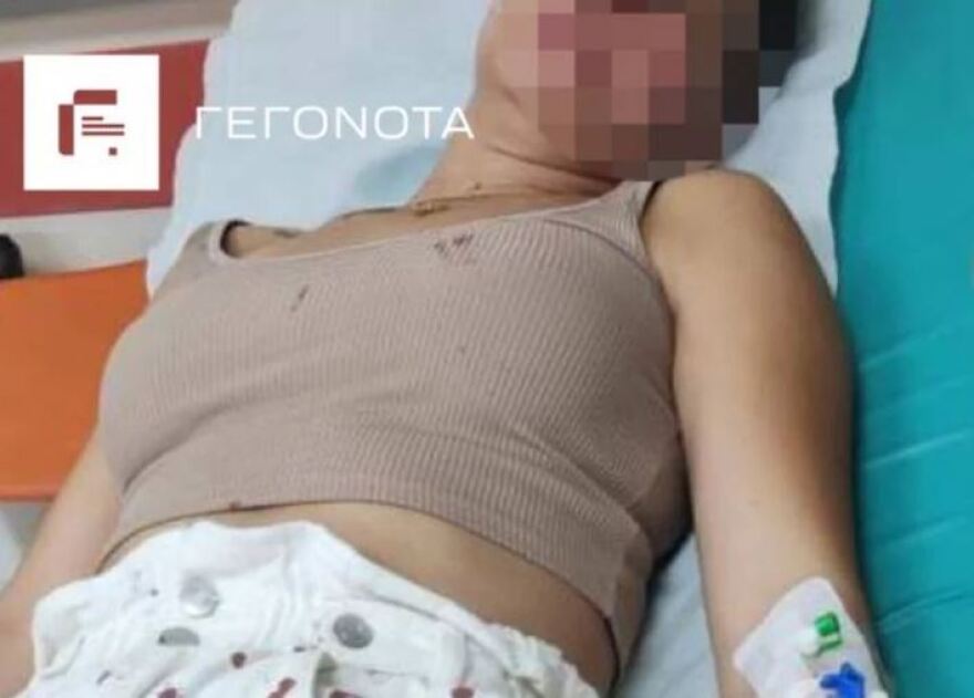 Βόλος: Διεθνής αθλητής κατηγορείται για τον ξυλοδαρμό της πρώην συζύγου του - Δείτε φωτογραφίες