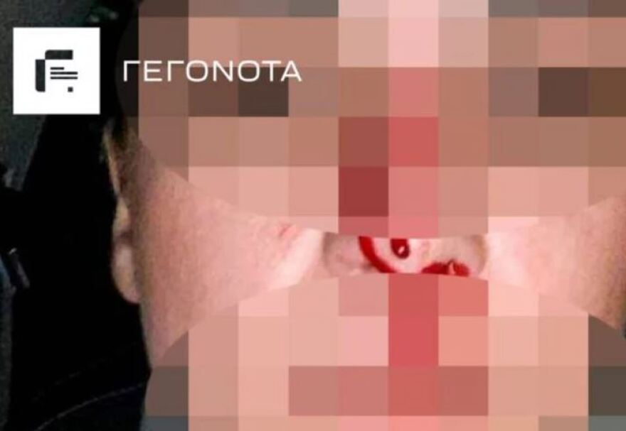 Βόλος: Διεθνής αθλητής κατηγορείται για τον ξυλοδαρμό της πρώην συζύγου του - Δείτε φωτογραφίες