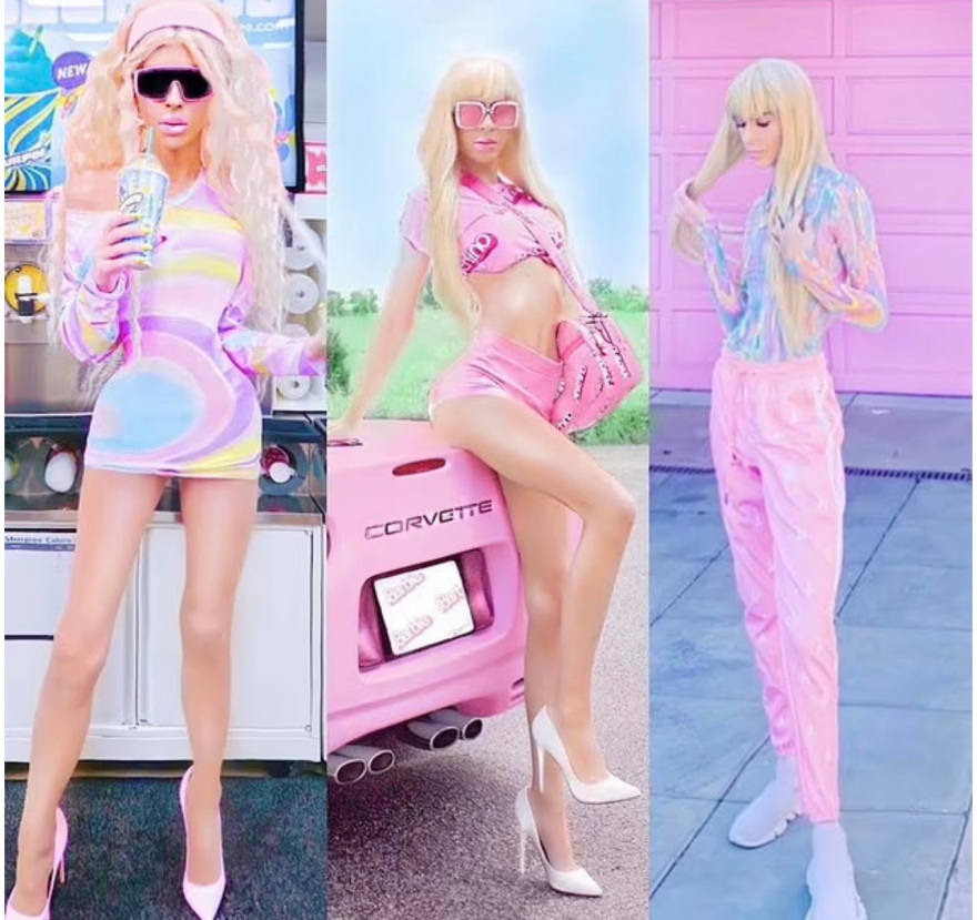 Νεαρός έγινε εκατομμυριούχος χάρη σε… sugar daddies και πλέον μοιάζει με τον Κεν της Barbie - Φωτογραφίες