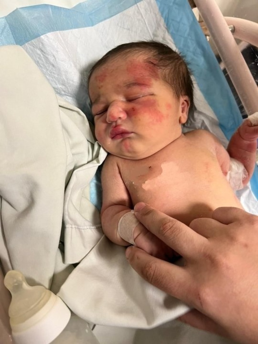 Συγκλονιστική ιστορία στον Λίβανο: Αδέσποτος σκύλος έσωσε μωρό που το είχαν πετάξει στα σκουπίδια