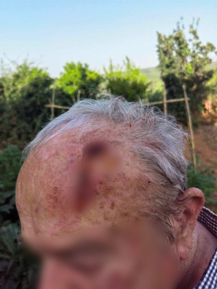 Χανιά: Στα κρατητήρια 33χρονος γαμπρός για μπαλωθιές στον γάμο του - Τραυματίστηκε 87χρονος σε διπλανό χωριό