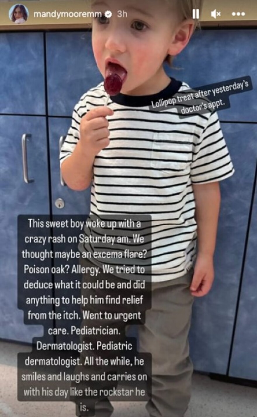 Μάντι Μουρ: Ο 2χρονος γιος της διαγνώστηκε με το σύνδρομο Gianotti-Crosti 