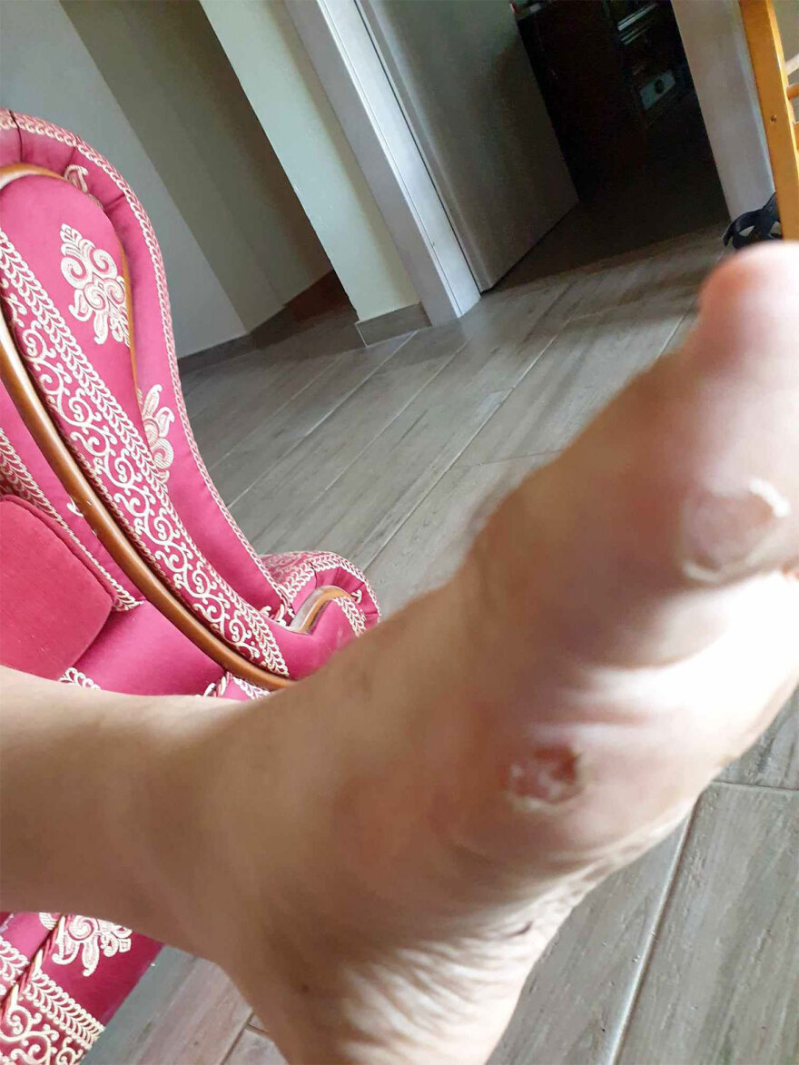 Κατασκήνωση ΑμέΑ της Μπούκας: «Αφού δεν φύγαμε από εκεί με χολέρα τυχεροί είμαστε», λέει συνοδός παιδιού