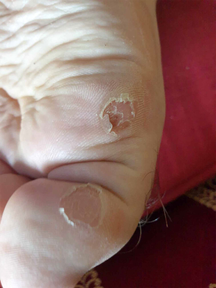 Κατασκήνωση ΑμέΑ της Μπούκας: «Αφού δεν φύγαμε από εκεί με χολέρα τυχεροί είμαστε», λέει συνοδός παιδιού