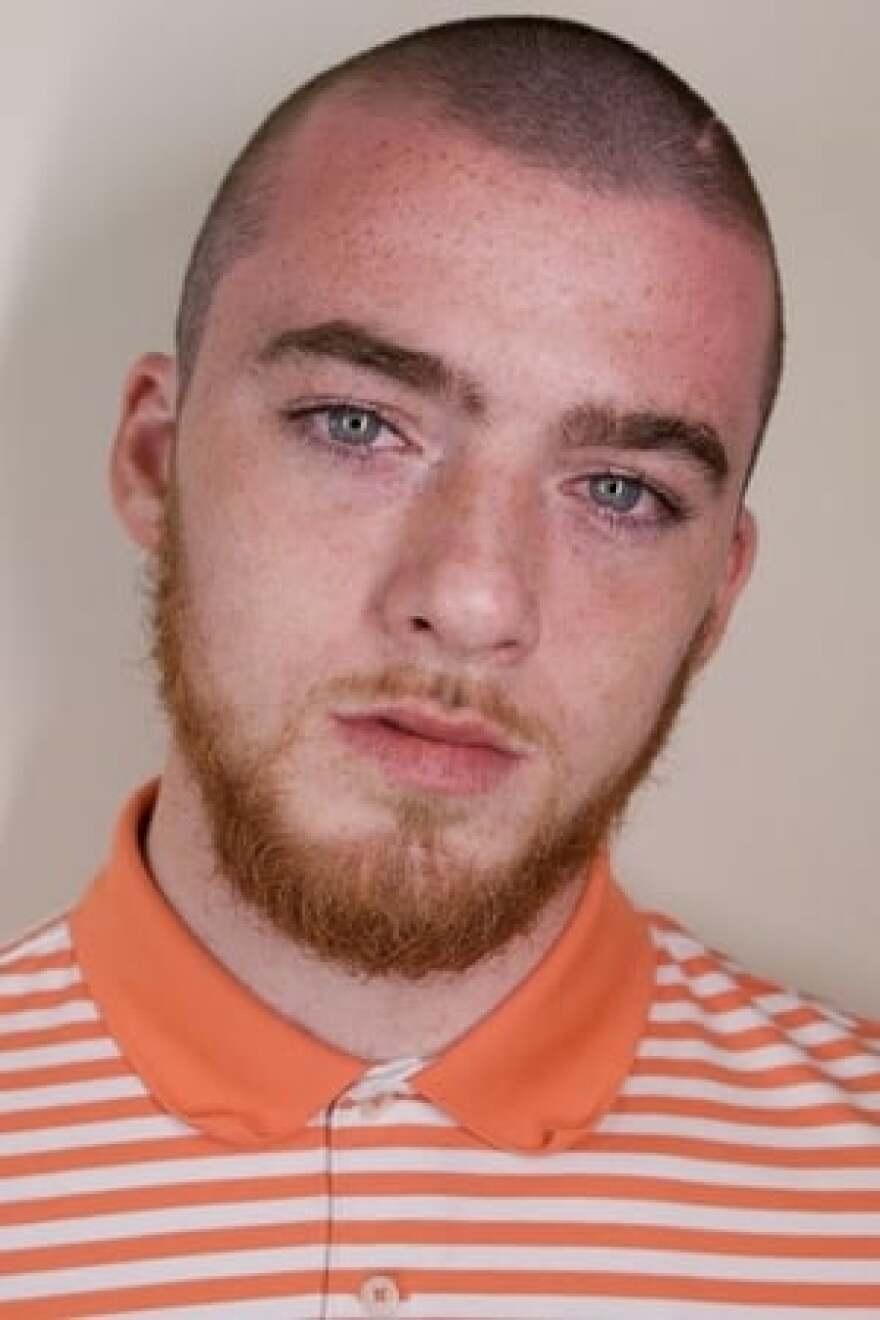 Άνγκους Κλάουντ: Τα έζησε όλα και πέθανε στα 25 - Η απότομη επιτυχία, τα ναρκωτικά και οι αυτοκτονικές σκέψεις