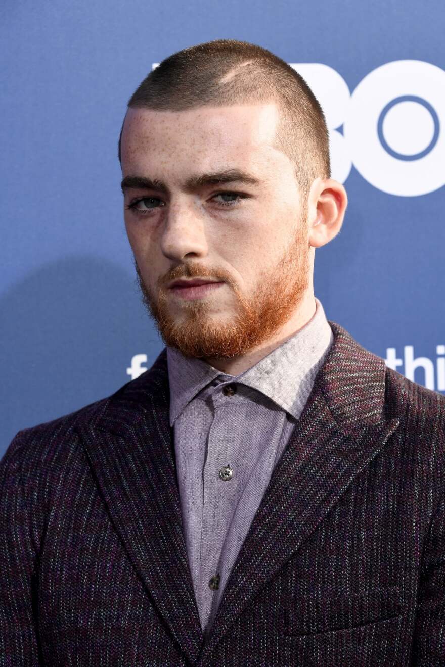 Άνγκους Κλάουντ: Τα έζησε όλα και πέθανε στα 25 - Η απότομη επιτυχία, τα ναρκωτικά και οι αυτοκτονικές σκέψεις