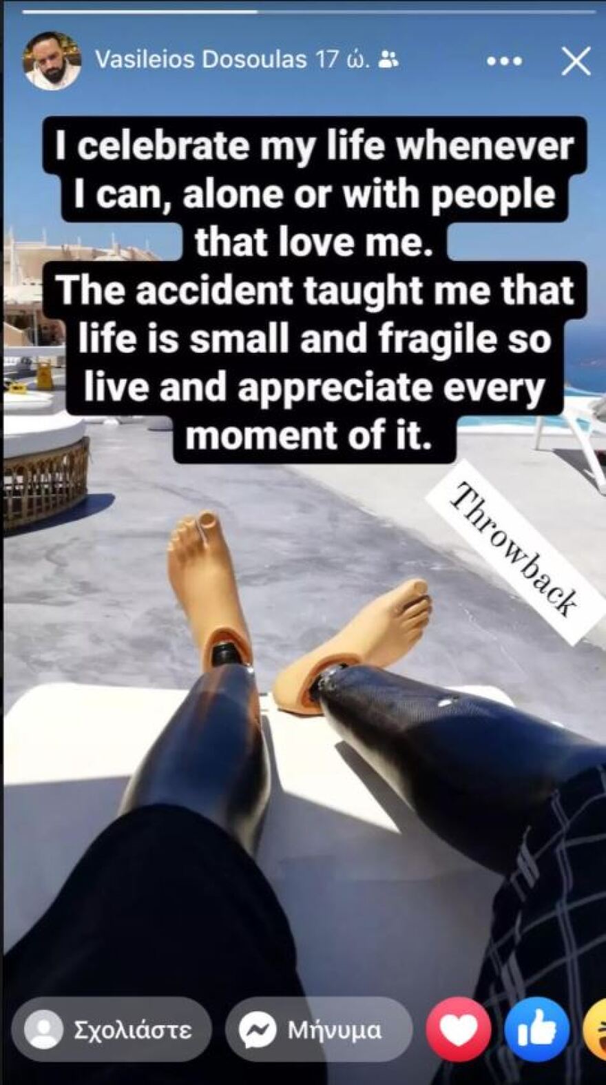 Βασίλης Δοσούλας: 29 χρόνια μετά το τραγικό ατύχημα δίνει μαθήματα ζωής