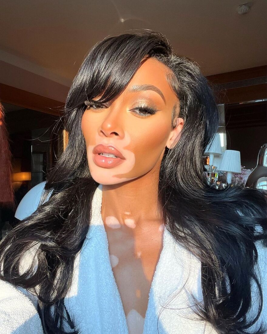 Γουίνι Χάρλοου: Το μοντέλο με τη λεύκη ποζάρει μόνο με το μπουρνούζι στο Instagram - Δείτε φωτογραφίες