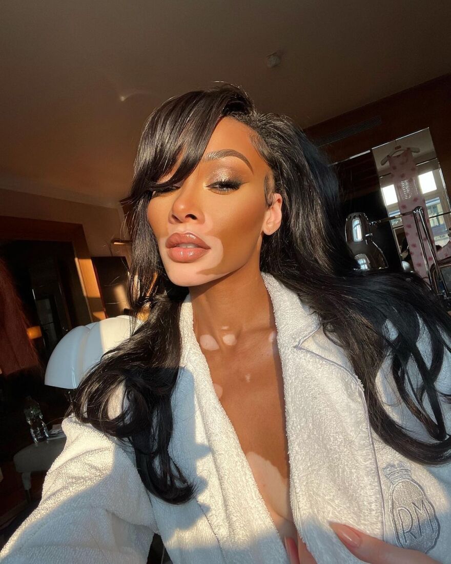 Γουίνι Χάρλοου: Το μοντέλο με τη λεύκη ποζάρει μόνο με το μπουρνούζι στο Instagram - Δείτε φωτογραφίες