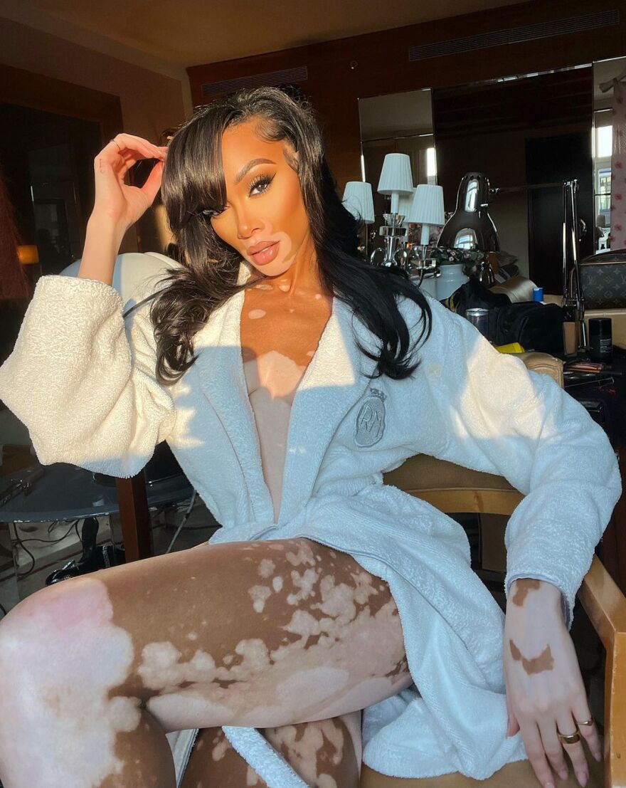 Γουίνι Χάρλοου: Το μοντέλο με τη λεύκη ποζάρει μόνο με το μπουρνούζι στο Instagram - Δείτε φωτογραφίες