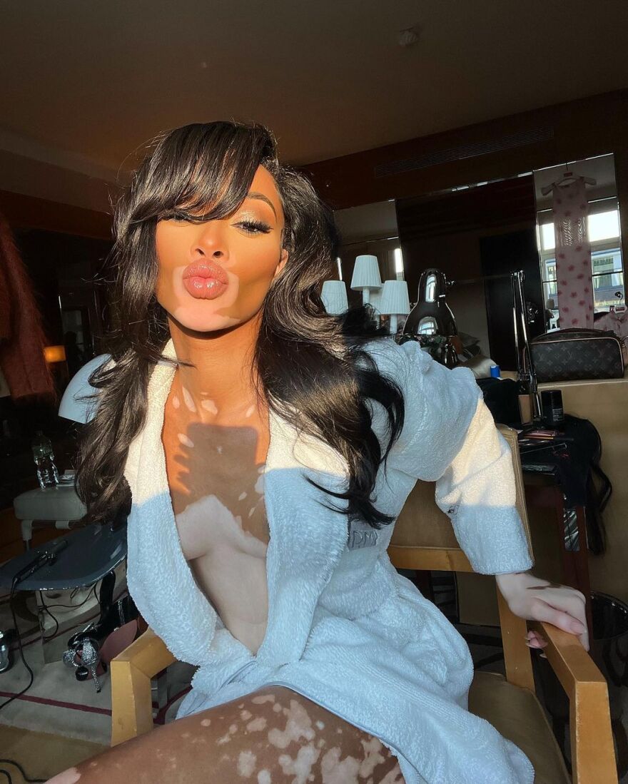 Γουίνι Χάρλοου: Το μοντέλο με τη λεύκη ποζάρει μόνο με το μπουρνούζι στο Instagram - Δείτε φωτογραφίες