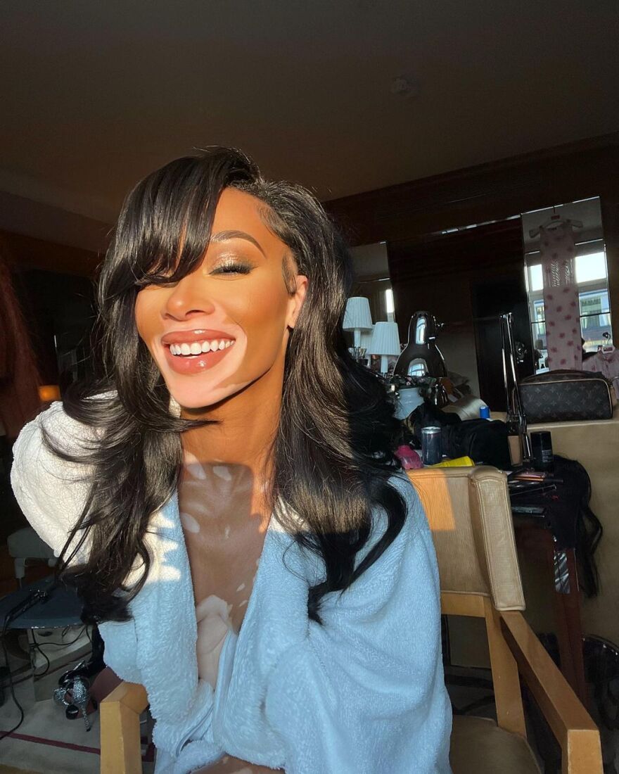 Γουίνι Χάρλοου: Το μοντέλο με τη λεύκη ποζάρει μόνο με το μπουρνούζι στο Instagram - Δείτε φωτογραφίες