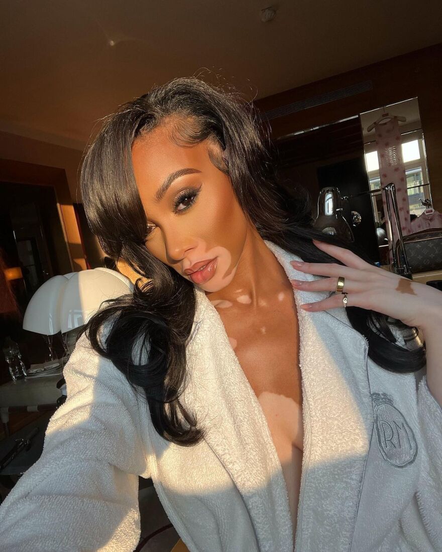 Γουίνι Χάρλοου: Το μοντέλο με τη λεύκη ποζάρει μόνο με το μπουρνούζι στο Instagram - Δείτε φωτογραφίες