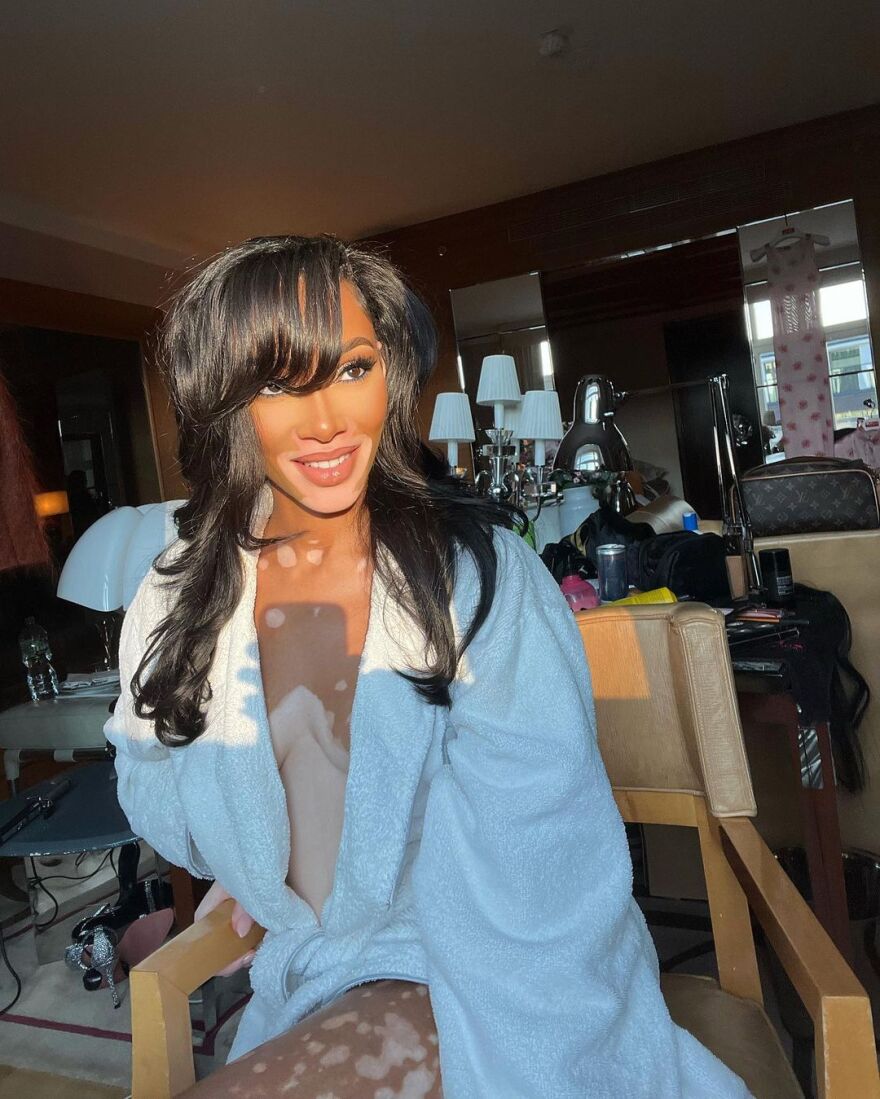 Γουίνι Χάρλοου: Το μοντέλο με τη λεύκη ποζάρει μόνο με το μπουρνούζι στο Instagram - Δείτε φωτογραφίες