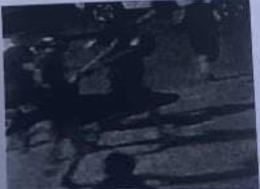 Νέα Φιλαδέλφεια: «Δεν μπορεί να ισορροπήσει, έχει ακατάσχετη αιμορραγία» - Η ανάλυση των βίντεο από τη δολοφονία του Μιχάλη