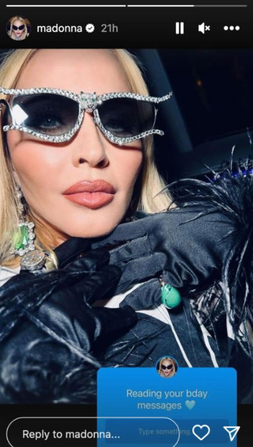 Μαντόνα: Φίλη της «πρόδωσε» πώς είναι στα 65 της η τραγουδίστρια