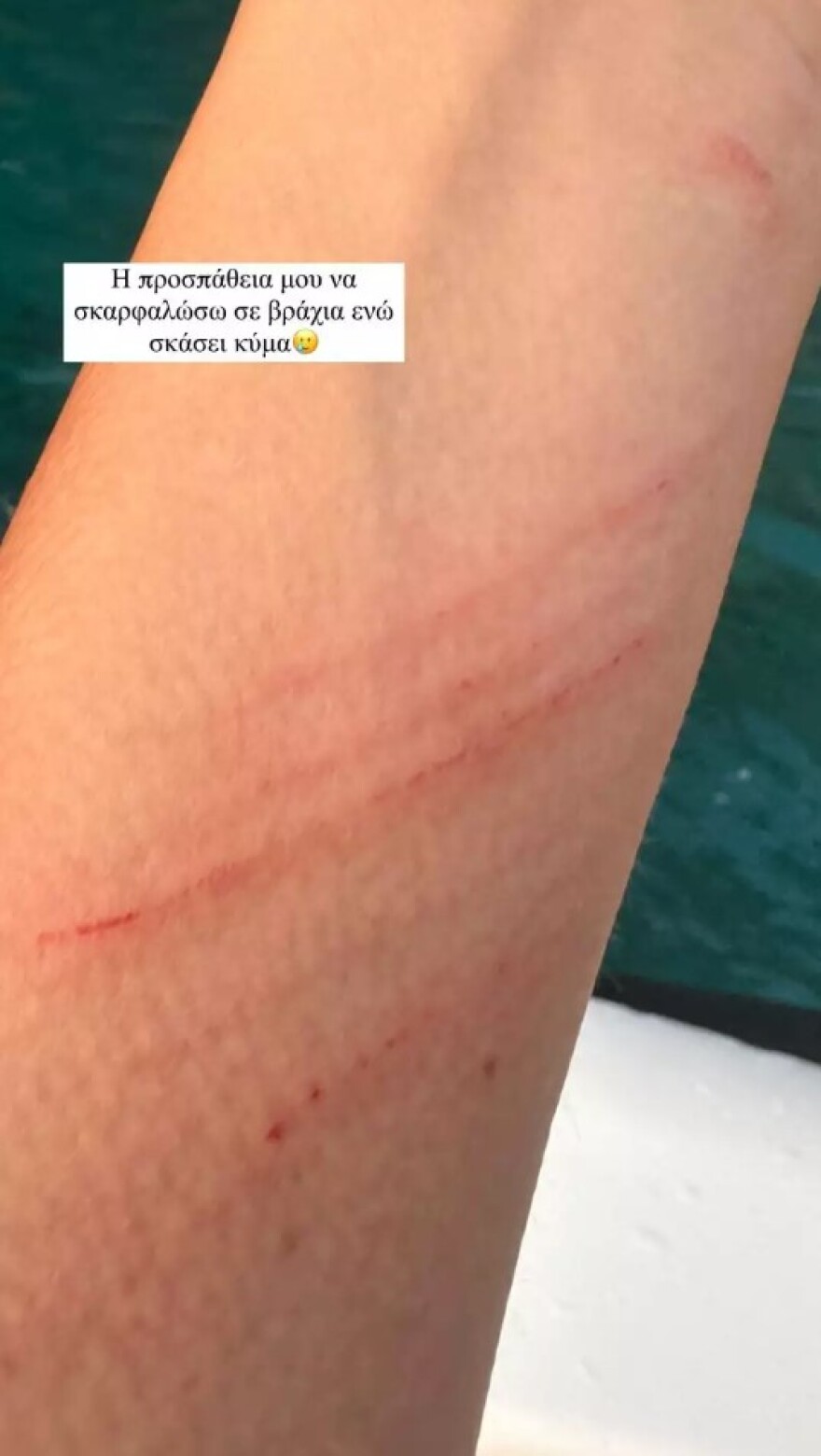 Φωτογραφίες: Το ατύχημα της Ιωάννας Τούνη σε βράχια στη θάλασσα